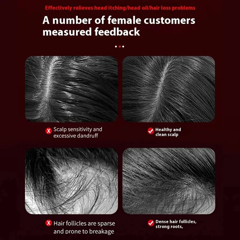 Electric Vibration Massage Com - Hair Care For Hair Loss review and price