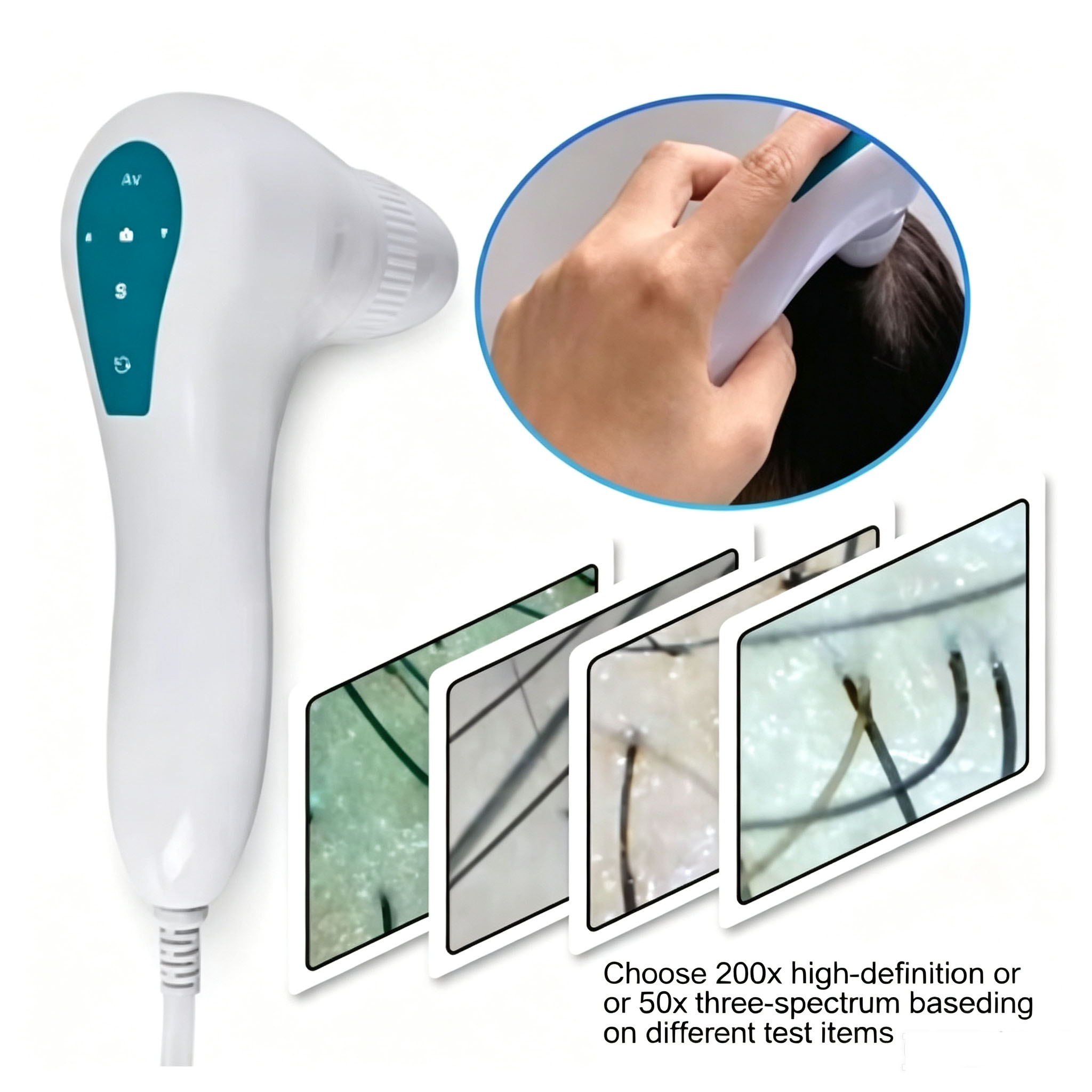Anti Hair Loss Scalp Hair Foll - Hair Care For Hair Loss review and price