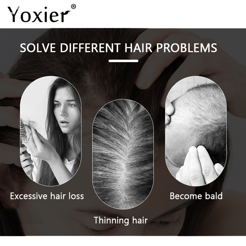 Intensive Growth Serum Prevent - Hair Care For Hair Loss review and price