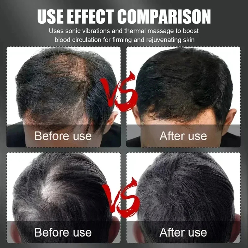 660nm 850nm Red Light Infrared - Hair Care For Hair Loss review and price